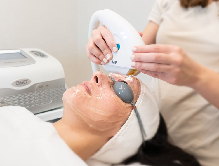 Aппарат IPL-терапии Ultralight фото 7