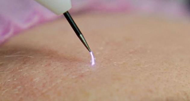 Электрод (молибденовый) для ручки-спрея (многоразовый) фото 2